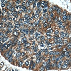 Melanophilin (MLPH) Antibody