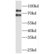 WB analysis of A375 cells, using MLPH antibody (1/1000 dilution).