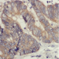 7SK snRNA Methylphosphate Capping Enzyme (MEPCE) Antibody