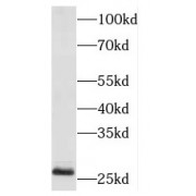 WB analysis of HEK-293 cells, using MESDC2 antibody (1/800 dilution).