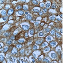 Methionine (MET) Antibody