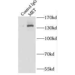 Methionine (MET) Antibody