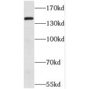 WB analysis of A431 cells, using MET antibody (1/300 dilution).