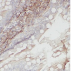 Methyltransferase Like 16 (METT10D) Antibody