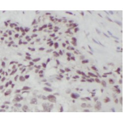 N6-Adenosine-Methyltransferase Catalytic Subunit (METTL3) Antibody