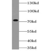WB analysis of HEK-293 cells, using METTL3 antibody (1/1000 dilution).