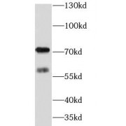 WB analysis of HeLa cells, using METTL4 antibody (1/500 dilution).