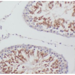 RING-Type E3 Ubiquitin Transferase MEX3C (MEX3C) Antibody
