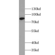 WB analysis of human kidney tissue, using MFN1 antibody (1/500 dilution).