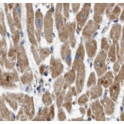 Mitofusin-2 (MFN2) Antibody