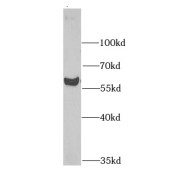 WB analysis of Y79 cells, using MGAT1 antibody (1/1000 dilution).