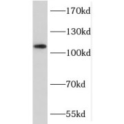 WB analysis of PC-3 cells, using MICALL2 antibody (1/1000 dilution).