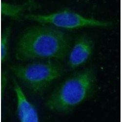 MIG6; ERRFI1 Antibody