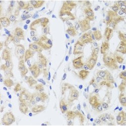 Major Intrinsic Protein of Lens Fiber (MIP) Antibody