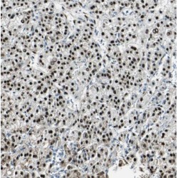 Mirror-Image Polydactyly 1 (MIPOL1) Antibody