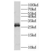 WB analysis of human brain tissue, using MLF2 antibody (1/400 dilution).