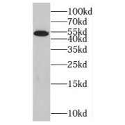 WB analysis of HeLa cells, using KIAA1804 antibody (1/1000 dilution).