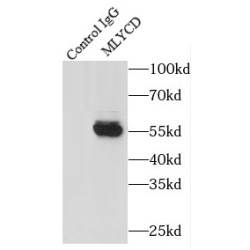 Malonyl-CoA Decarboxylase, Mitochondrial (MLYCD) Antibody