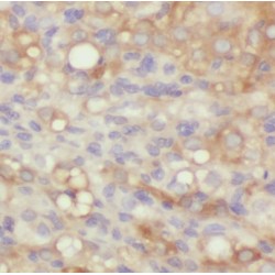Methylmalonic Aciduria Type B Protein (MMAB) Antibody