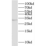 WB analysis of Raji cells, using MMACHC antibody (1/600 dilution).