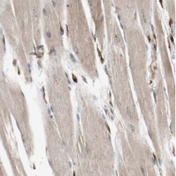 Methylmalonic Aciduria And Homocystinuria Type D Homolog, Mitochondrial (MMADHC) Antibody