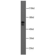 WB analysis of A549 cells, using MMP1 antibody (1/1000 dilution).
