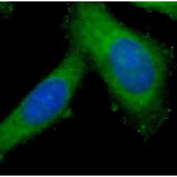 Macrophage Metalloelastase (MMP12) Antibody