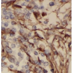 Macrophage Metalloelastase (MMP12) Antibody