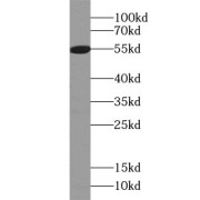 WB analysis of mouse brain tissue, using MMP12 antibody (1/600 dilution).