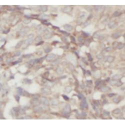 Collagenase 3 (MMP13) Antibody