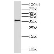 WB analysis of HeLa cells, using MNAT1 antibody (1/500 dilution).