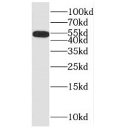 WB analysis of HeLa cells, using MNK1 antibody (1/600 dilution).