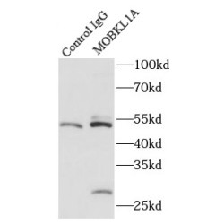 MOB Kinase Activator 1B (MOBKL1A) Antibody