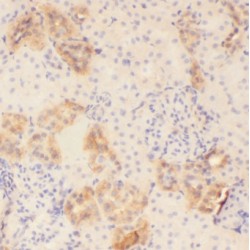 Monoacylglycerol-O-Acyltransferase 2 (MOGAT2) Antibody