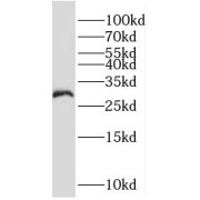 WB analysis of HL-60 cells, using MOGAT2 antibody (1/300 dilution).