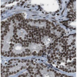 Mov10 RISC Complex RNA Helicase (MOV10) Antibody