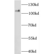 WB analysis of HEK-293 cells, using MOV10 antibody (1/800 dilution).