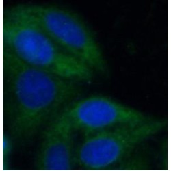 Mitochondrial Pyruvate Carrier 2 (MPC2) Antibody