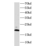 WB analysis of mouse brain tissue, using MPC2 antibody (1/1000 dilution).