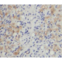 Myosin Phosphatase Rho Interacting Protein (MPRIP) Antibody