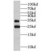 WB analysis of Jurkat cells, using MPZL2 antibody (1/800 dilution).