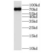 WB analysis of mouse liver tissue, using MPZL3 antibody (1/1000 dilution).