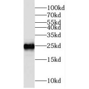 WB analysis of mouse brain tissue, using MRAS antibody (1/300 dilution).