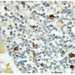 Double-strand break repair protein MRE11A (MRE11) Antibody