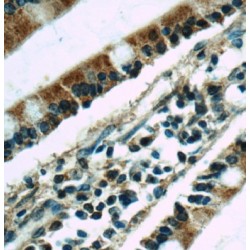 Canalicular Multispecific Organic Anion Transporter 1 (ABCC2) Antibody