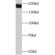 WB analysis of HepG2 cells, using ABCC2 antibody (1/600 dilution).
