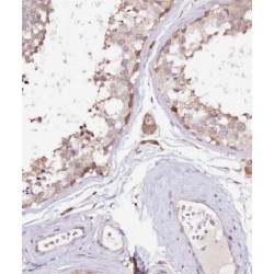 Mitochondrial Ribosomal Protein L19 (MRPL19) Antibody