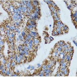 Mitochondrial Ribosomal Protein L28 (MRPL28) Antibody