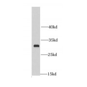 WB analysis of A375 cells, using MRPL28 antibody (1/1000 dilution).