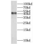 WB analysis of mouse brain tissue, using MRPL38 antibody (1/500 dilution).